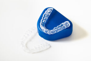 Ortho Retainers: A Necessary step post alignment