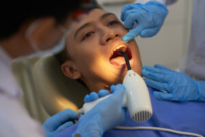 What Is the Procedure for Filling a Cavity?